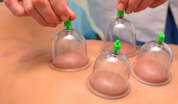 <b>Jasa Bekam Profesional</b>